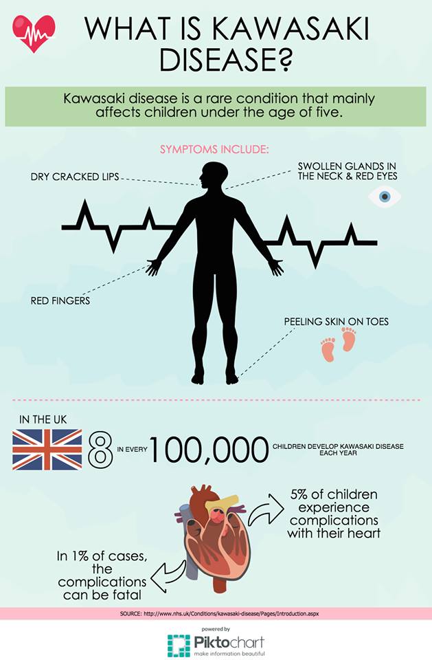 Kawasaki disease