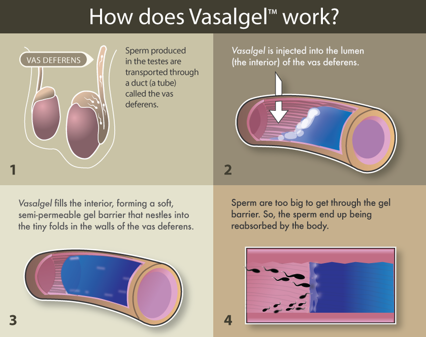 How Vasalgel works