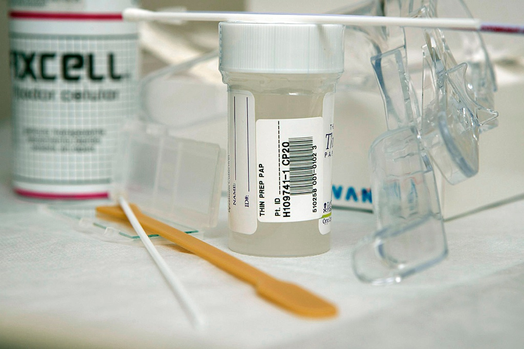 Nine out of ten cancer cases 'could be prevented with smear test' Nine out of ten cancer cases 'could be prevented with smear test'