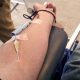 Photo of a person's arm during the blood donation process.