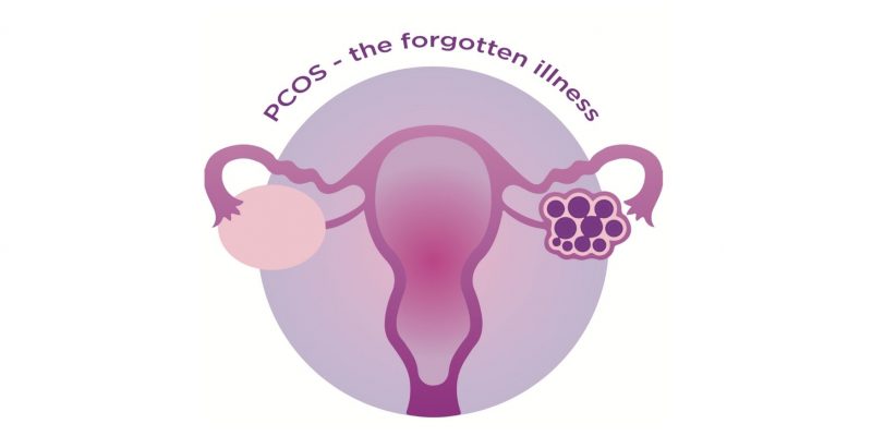 PCOS - The Forgotten Illness Logo
